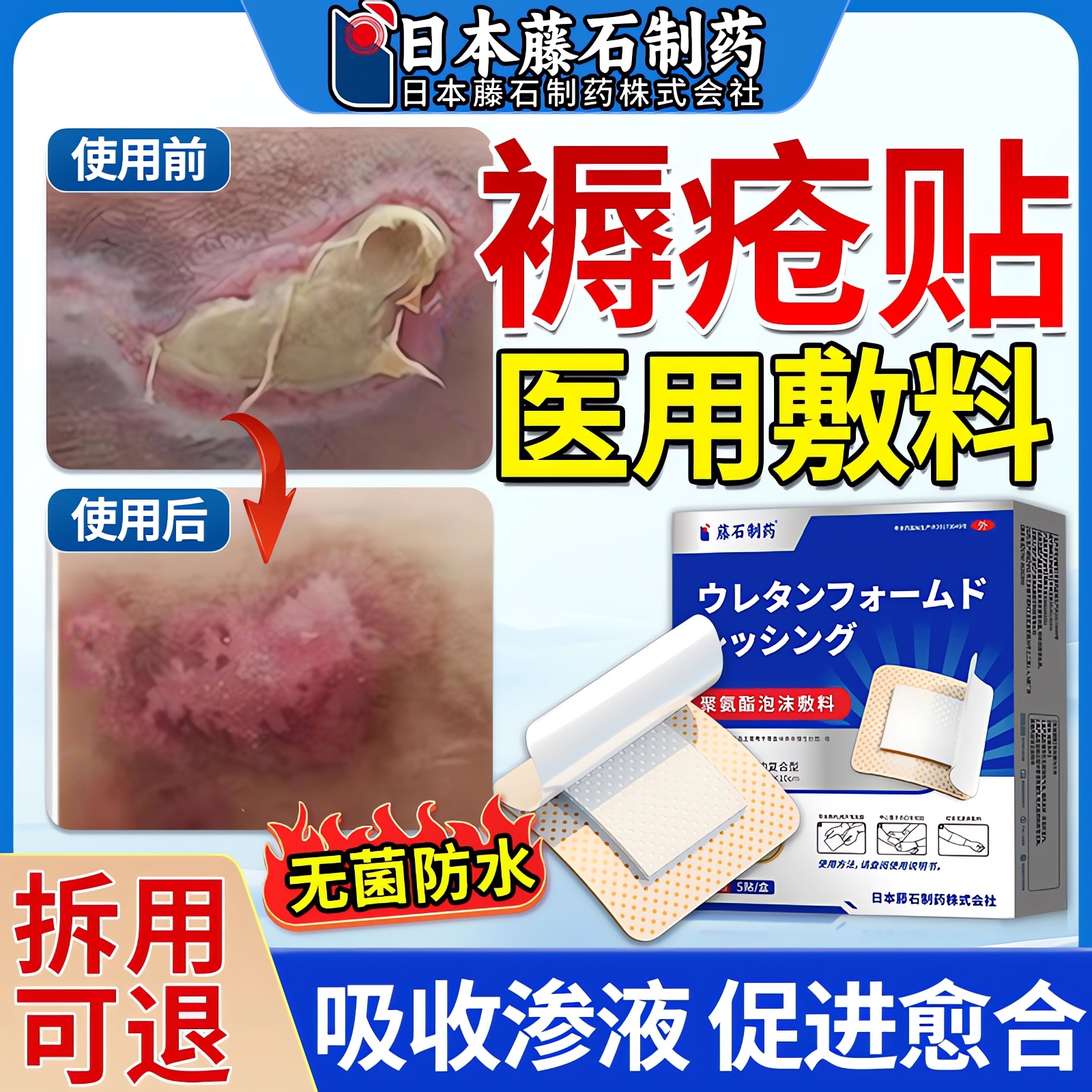 【日本品牌】褥疮压疮医用无菌贴