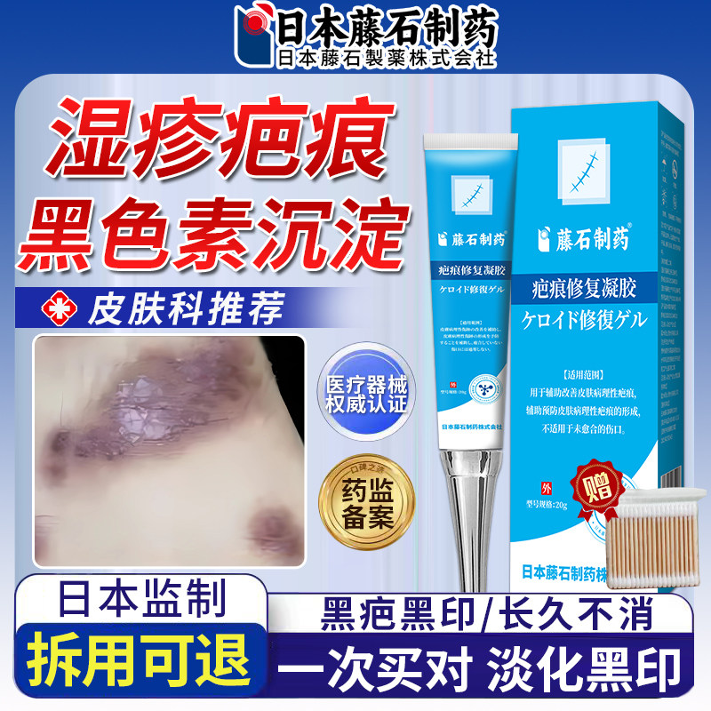 【拆用可退】湿疹疤痕黑色素沉淀