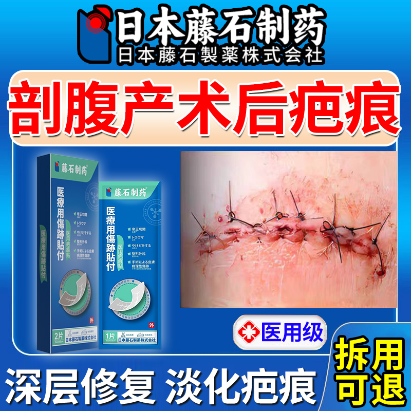 【拆用可退】剖腹产术后疤痕专用