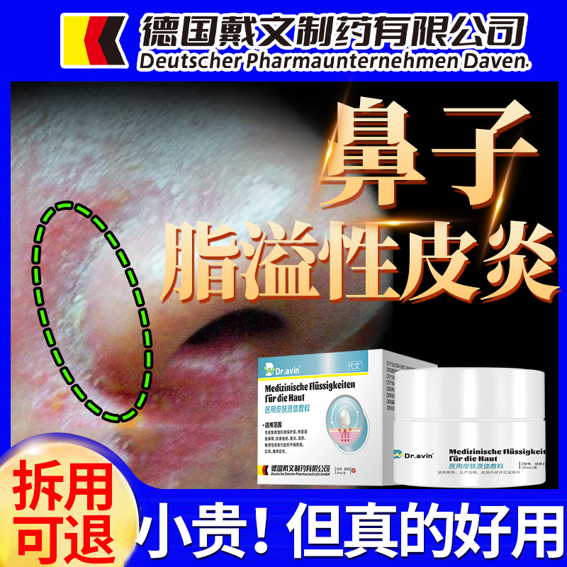 【德国品牌】鼻子两侧脂溢性皮炎