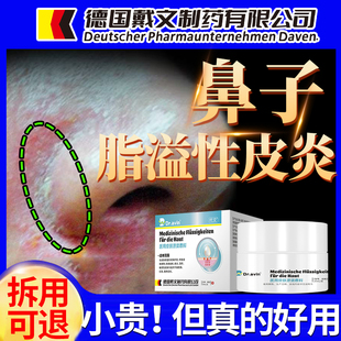 鼻子两侧脂溢性皮炎面部软膏鼻翼泛红干燥脱皮马拉色菌药监备案ZR