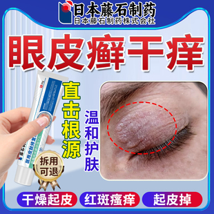 眼皮癣眼睛周围眼角痒干燥起皮掉屑神经皮炎红肿过敏痒可搭药膏ZR