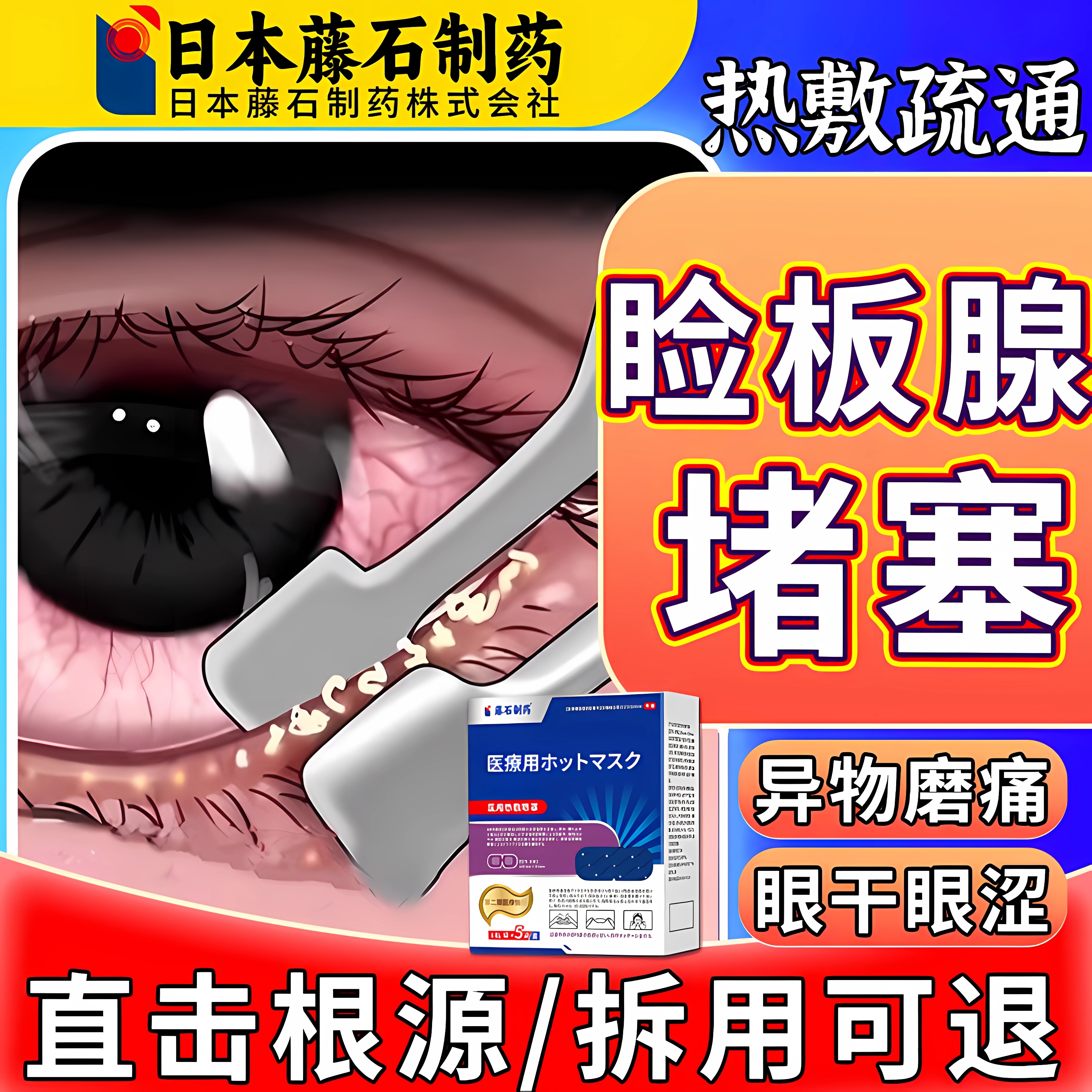 【拆用可退】睑板腺堵塞热敷疏通