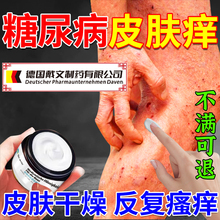 Dr.avin糖尿病引起的皮肤瘙痒专用止痒膏高血糖皮肤痒可搭膏药ZR