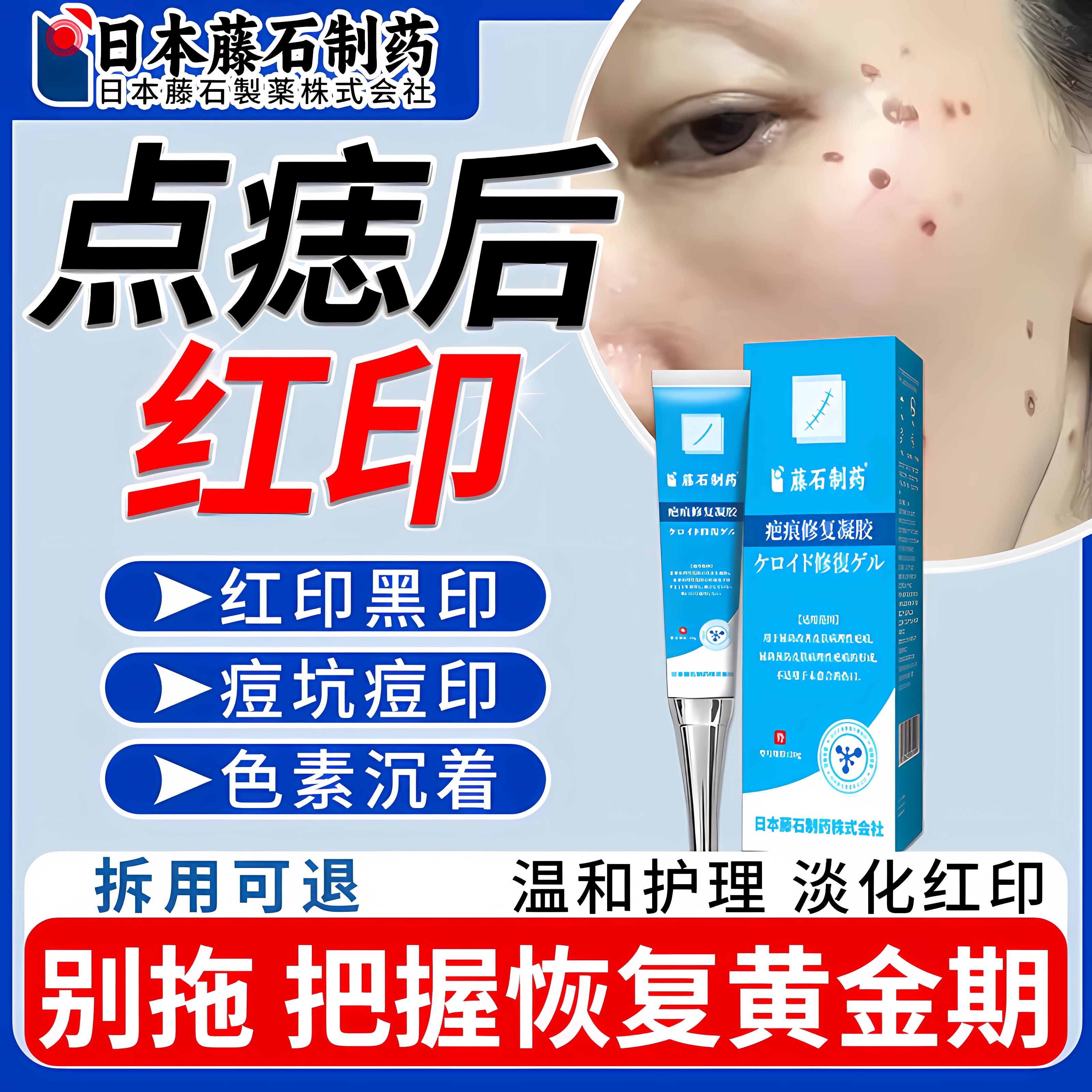 【拆用可退】点痣后去红印修复膏