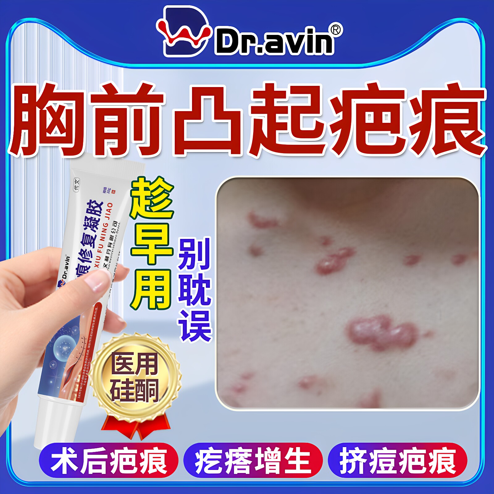 胸口前疤痕增生凸起去除疙瘩止痒凝胶祛手术疤痕痘痘硬肉医用膏ZR