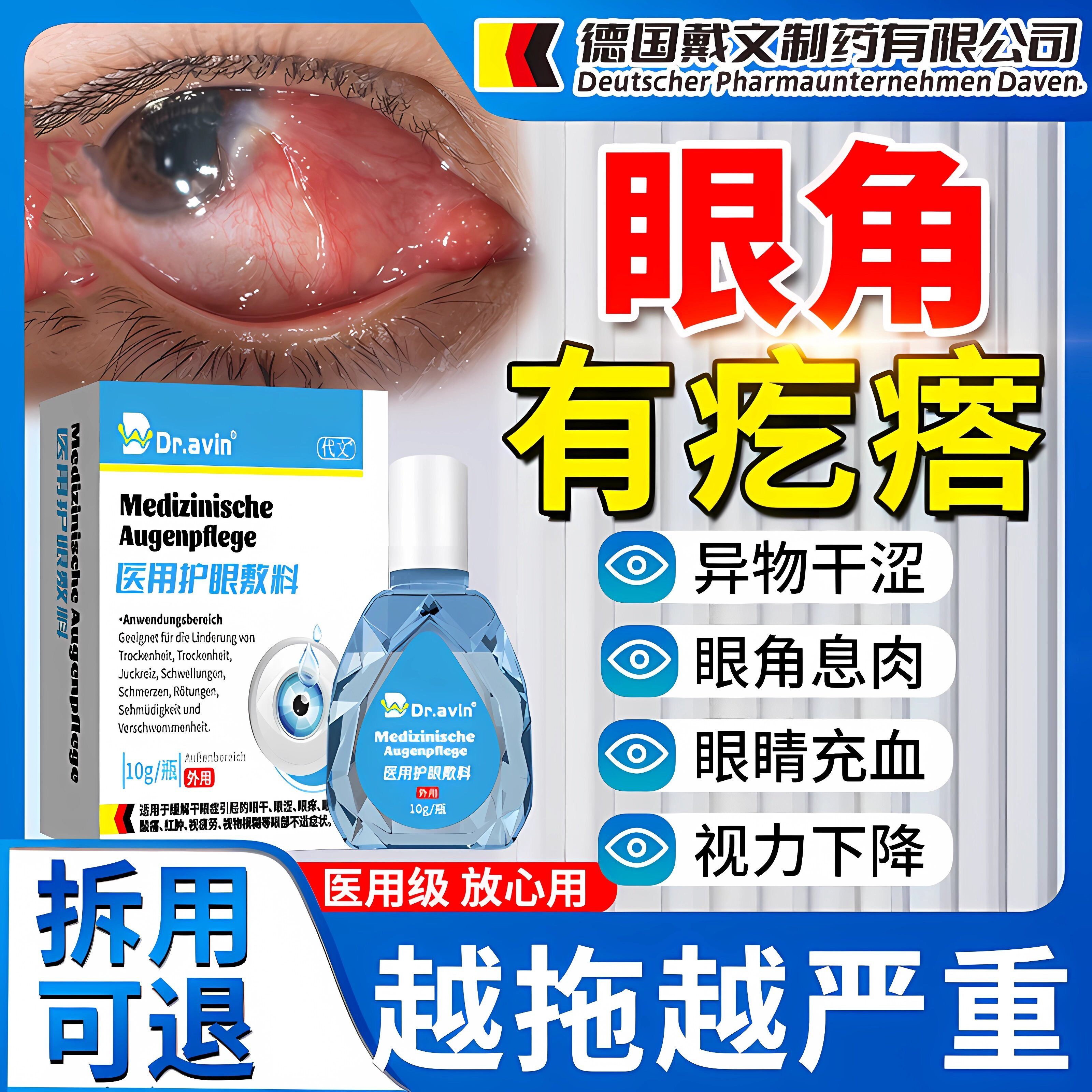 去眼睛胬肉可搭滴眼液眼药水除眼角长翼状胬肉息肉眼异物感模糊ZR