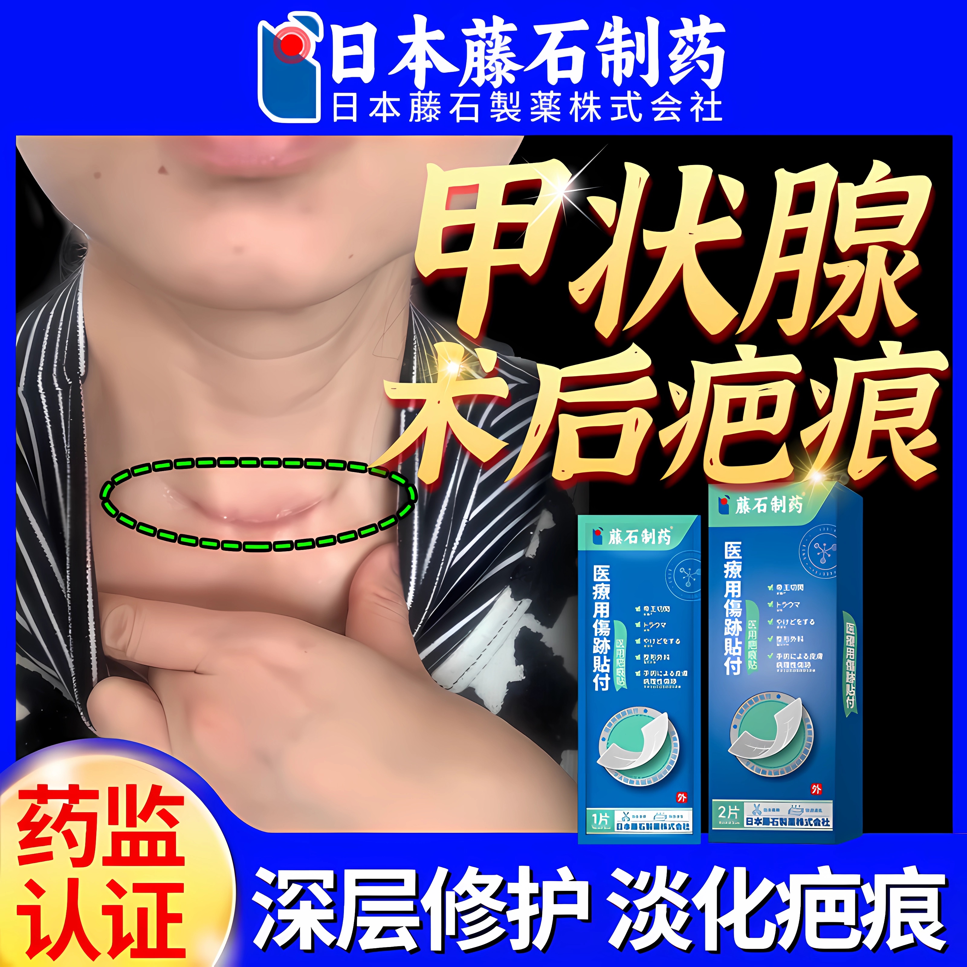【医用级】甲状腺术后疤痕修复贴