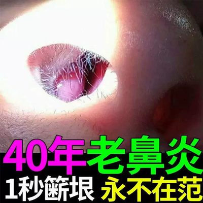 鼻炎片中成药通窍苍耳子治疗专用药成人儿童鼻窦炎根非特效进口Q