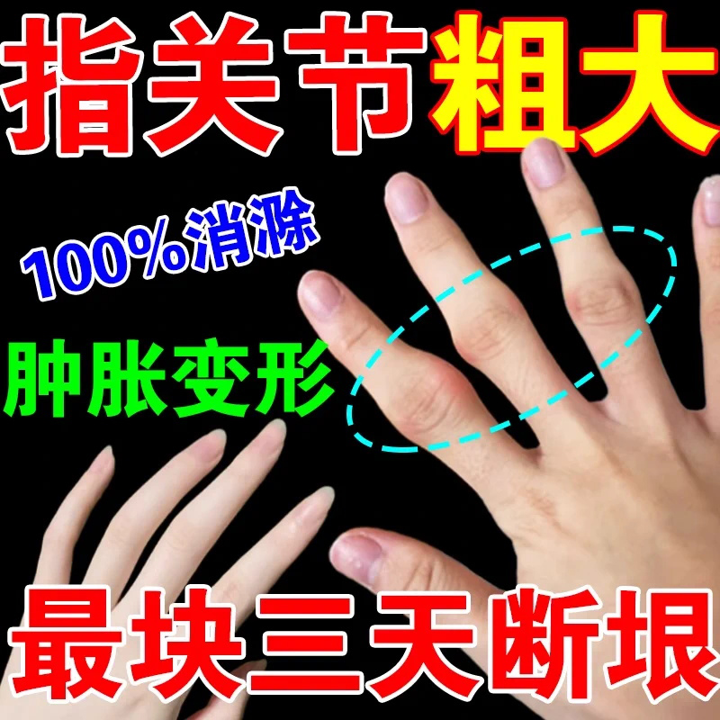 仁和大活络丸8袋风湿性关节炎骨关节炎专用药祛风散寒除湿化痰