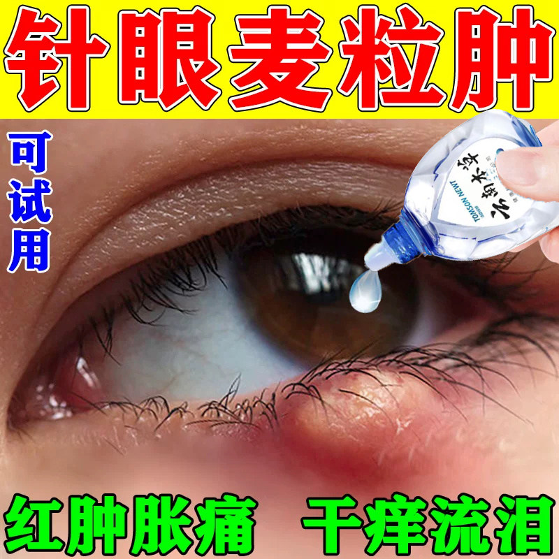 金霉素眼膏皮肤疖肿睑缘炎麦粒肿细菌性结膜炎细菌性眼睑炎角膜炎
