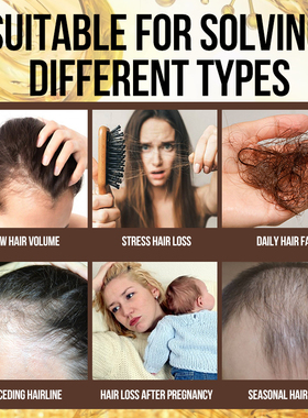 极速Sevich Hair Growth Stpray Serum Ginger Anti Hair Loss Fa