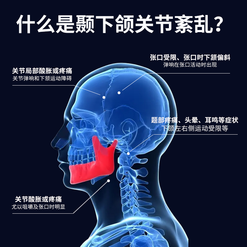 极速颞下颌关节紊乱颌垫下巴颌骨后缩大小脸O嘴歪偏颌弹响热敷专