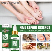 Fungus Foot Treatments Serum 极速Nail Care Repzair Feet Fung