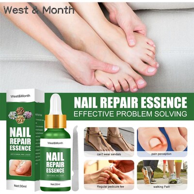 极速Nail Fungus Treatments Repzair Serum Feet Care Foot Fung