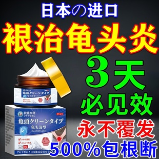 龟头炎专用膏药真菌感染男士特效包皮炎霉菌性止痒去除小红点乳膏