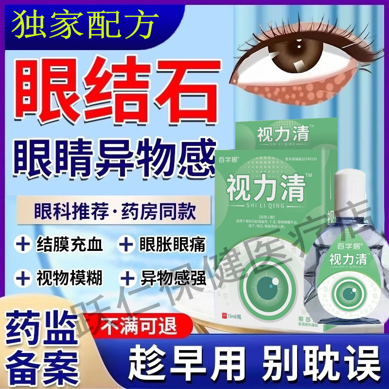 眼结石去除滴眼液眼睛有异物感可搭配干涩眼药水胀痛模糊看不清