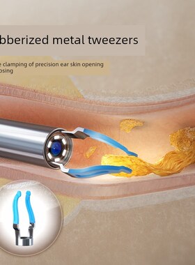 bebird智能视觉耳勺独家耳勺头配件[Bebird3Plus专用,而不是产品