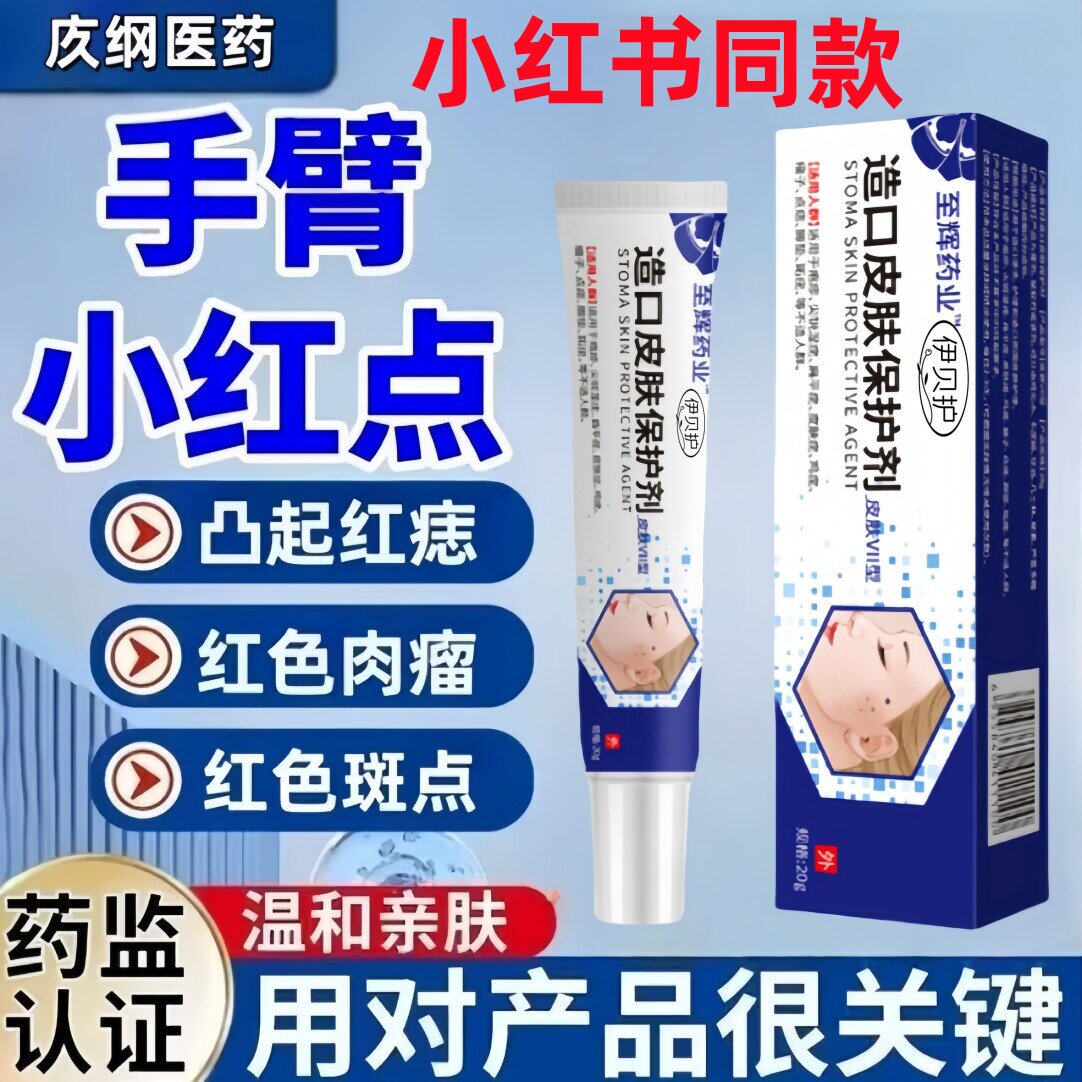 伊贝护血管瘤血管痣淡化修护管瘤