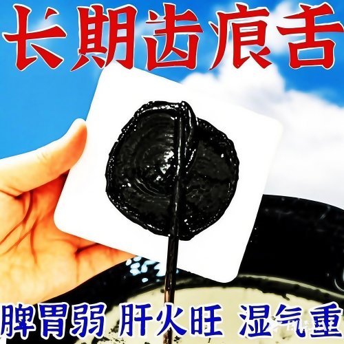 上热下寒足贴吴茱萸肉桂引火归元上火口腔贵溃疡中焦不通通三焦