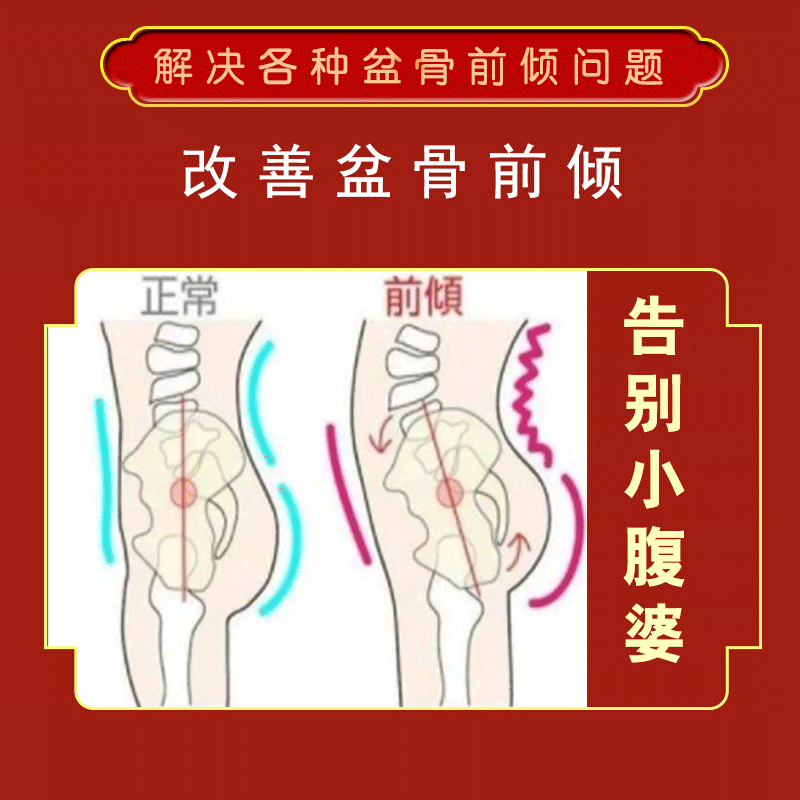 网红冶假胯宽骨盆前倾收缩骨盆矫正腰疼胯骨尾巴骨疼小腹凸起产后