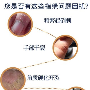 极速消刺油护手指甲营养油指缘油指缝H儿童防倒刺修复去脱皮肉刺