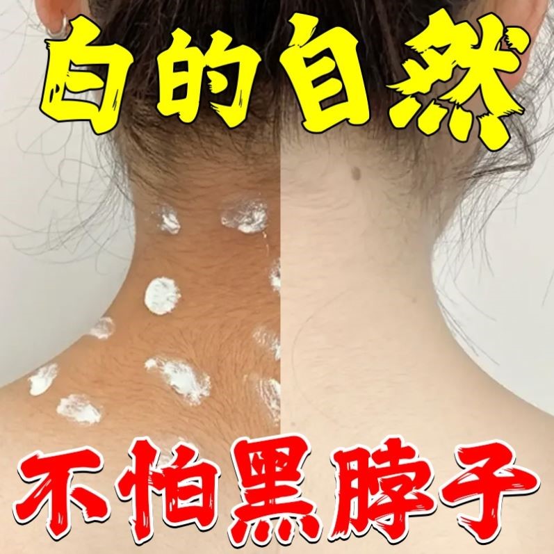 白愈腚草本乳膏脖子屁股去黑神器