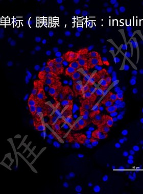 免疫组化(IHC)免疫荧光(IF) Tunel 凋亡 细胞实验图片量化分析