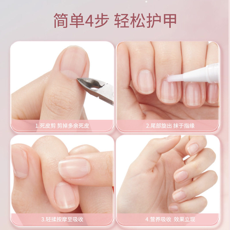 FEILINKA妃琳卡旋转香氛指缘油防死皮倒刺滋润皮肤边缘营养护甲油图片