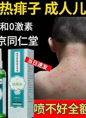 热痱水痱子止成人喷雾儿童宝宝婴儿痒痱子水去痱祛痱神器粉除长菲