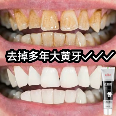 黄牙速效变白去口臭去牙垢去烟渍茶渍清洁牙齿口腔护理美白牙膏
