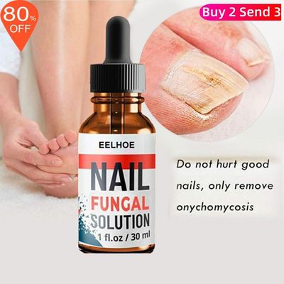 Foot Finger Liquid Anti Fungal Repair Serum Nail Removal Gel