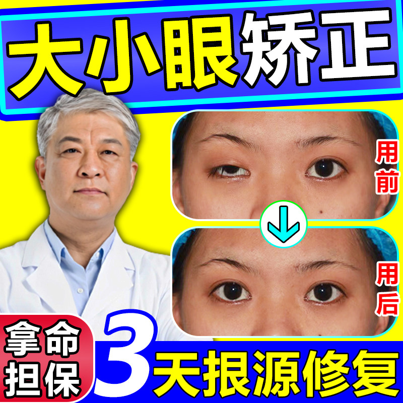 好货大小眼矫正器眼皮下垂提拉贴双眼皮去肿上眼睑松弛肌无力提拉