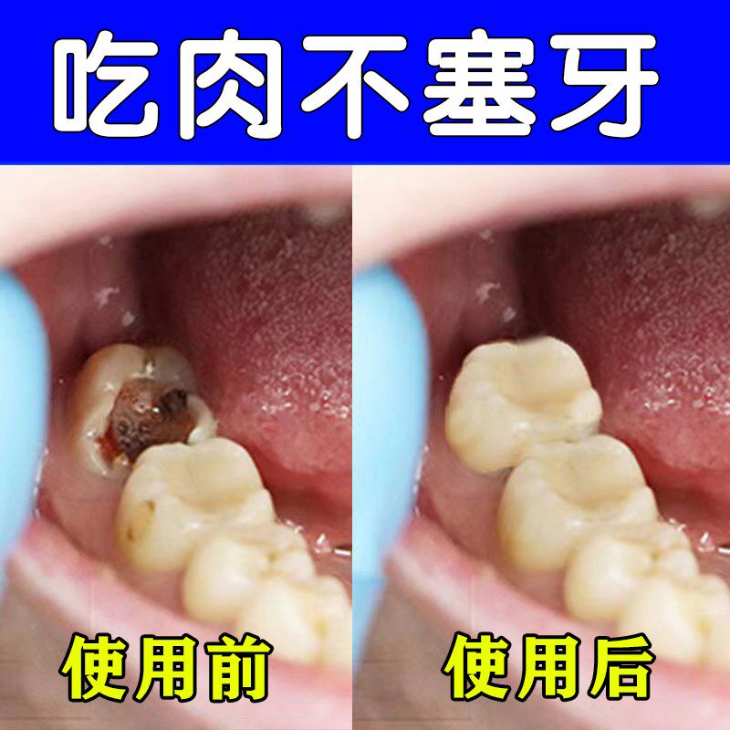 【日本黑科技牙膏】牙齿爱护计划 轻松解决口腔问题 男女儿童适用