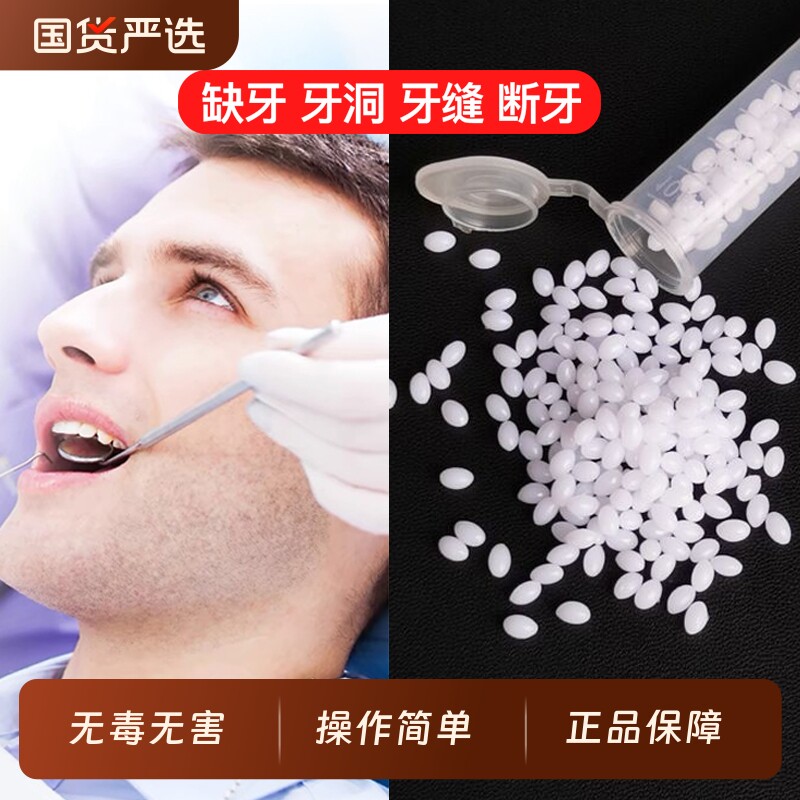 补牙材料树脂牙齿自己在家牙缝洞神器填充膏假牙牙套自补修补临时