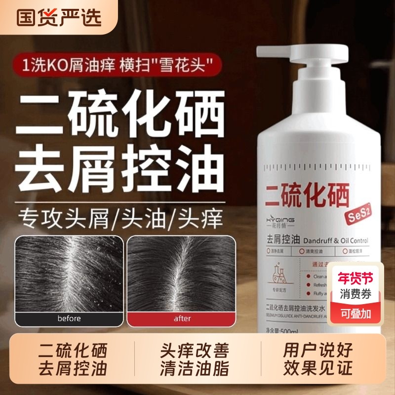 二硫化硒洗发水控油蓬松去屑清洁毛囊洗头液膏露女男士官方正品牌,美发护发/假发,洗发水,淘宝优惠券,粉丝福利购,淘宝优惠卷