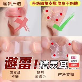 蝴蝶精灵耳贴强支撑女生隐形显脸小固定招风耳矫正器立耳定型神器