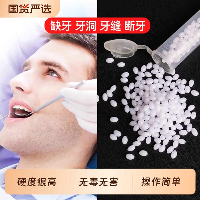 树脂补牙材料牙齿自己在家牙缝洞神器填充膏假牙牙套自补修补临时