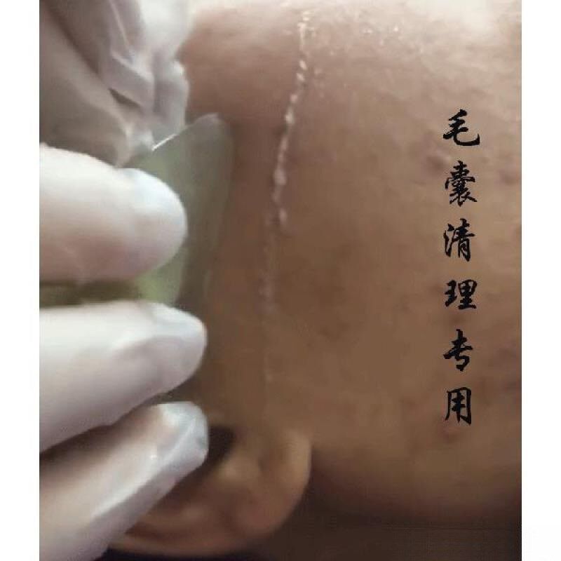 现货速发面部刮痧片黑头刮板毛囊清洁术刮痧板脸部薄毛孔清理产品