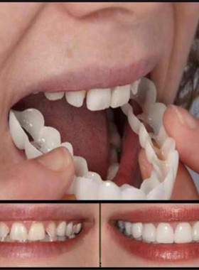 极速2 Pcs Vehneers Set Silicone Dentures 3D Whitening Strips