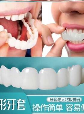 极速牙套可吃饭神器防塞牙v缺门牙缝临时遮盖男女全口仿真假牙套