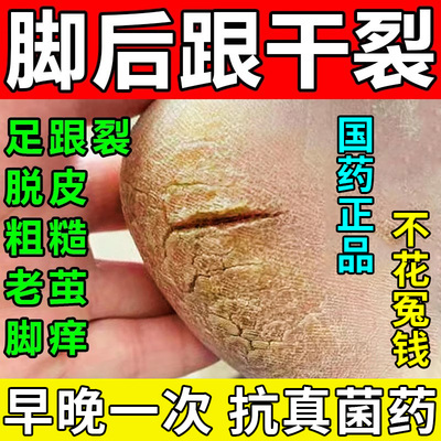 【亿帆】尿素维E乳膏50g7.5g*50g*1支/盒