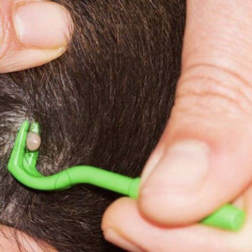 极速Flea Remover Hook Tick Removal Tweezer Ticks PulXl Pet C
