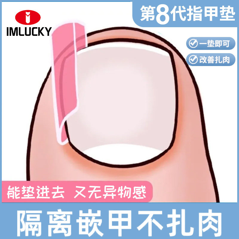 甲沟矫正器脚指甲肉包卷甲嵌甲隔离垫片正甲贴甲片甲沟专用神器护,家庭/个人清洁工具,美甲/修甲套装,淘宝优惠券,粉丝福利购,淘宝优惠卷