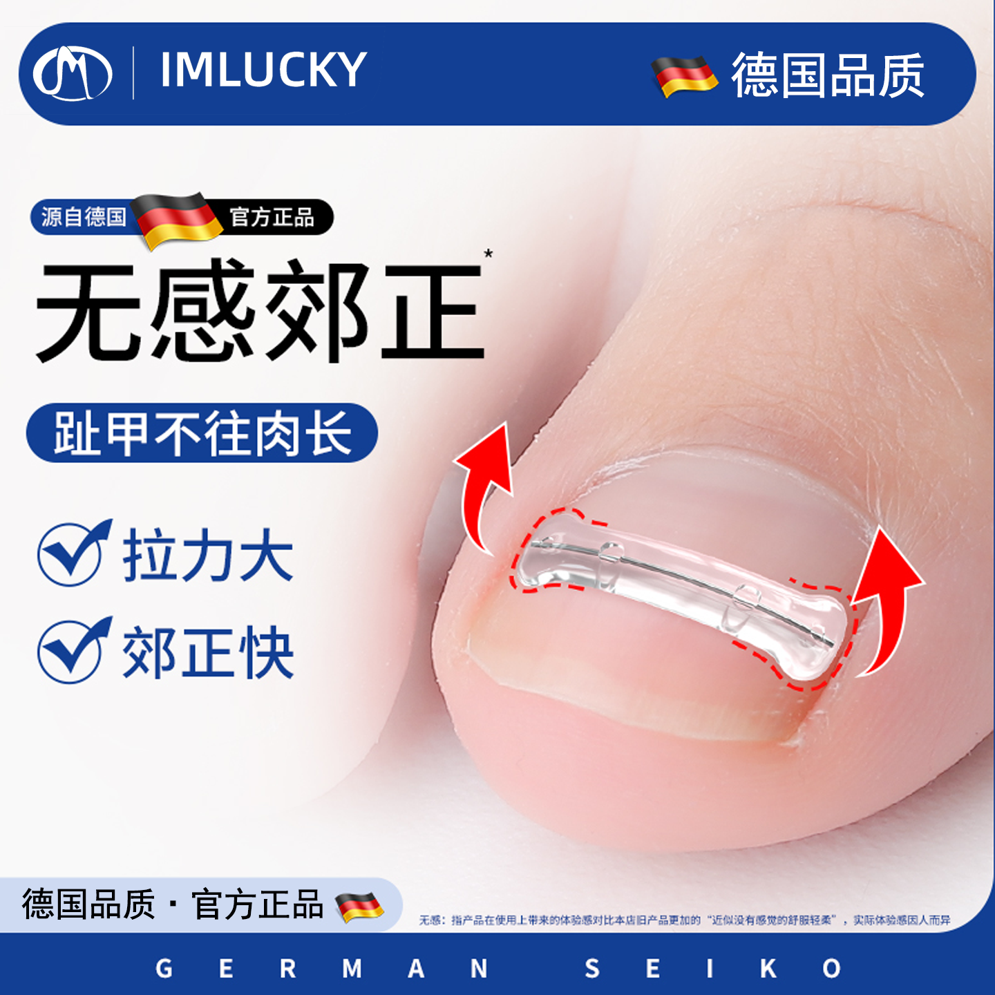 德国工艺甲沟矫正贴片