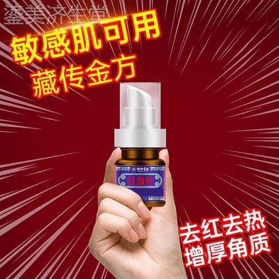 极速敏感a肌修复脸部泛红水乳脸红红血丝护肤品套组男脸角质层