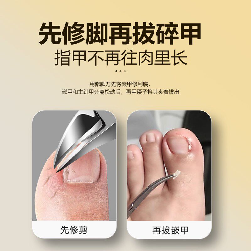 速发甲沟镊子夹指甲往肉里长专用脚趾工具神器剪刀炎钳技师修剪