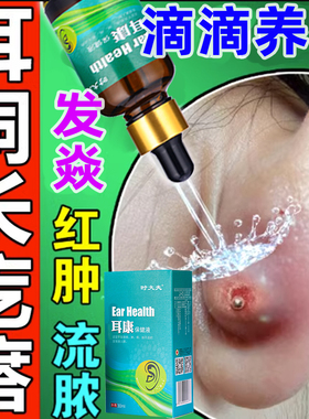新品耳洞增生疙瘩护理耳康u液耳朵发焱专用清洁液疤痕增生凸起去