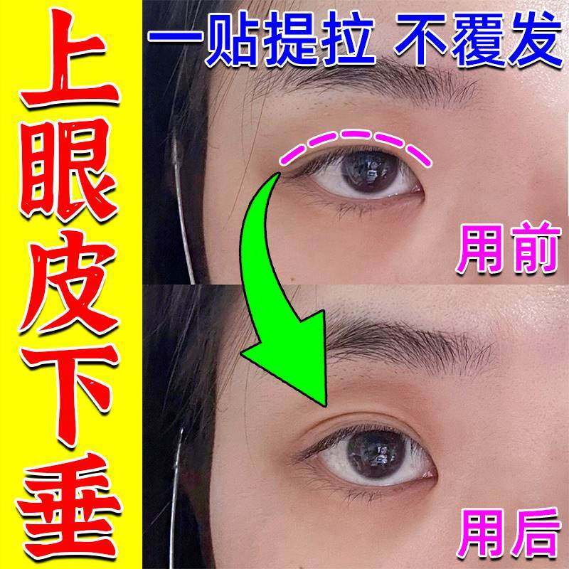 极速眼皮松弛提拉紧致眼皮下x垂贴上眼睑眼皮红肿痒定型双眼皮神,彩妆/香水/美妆工具,双眼皮贴,淘宝优惠券,粉丝福利购,淘宝优惠卷