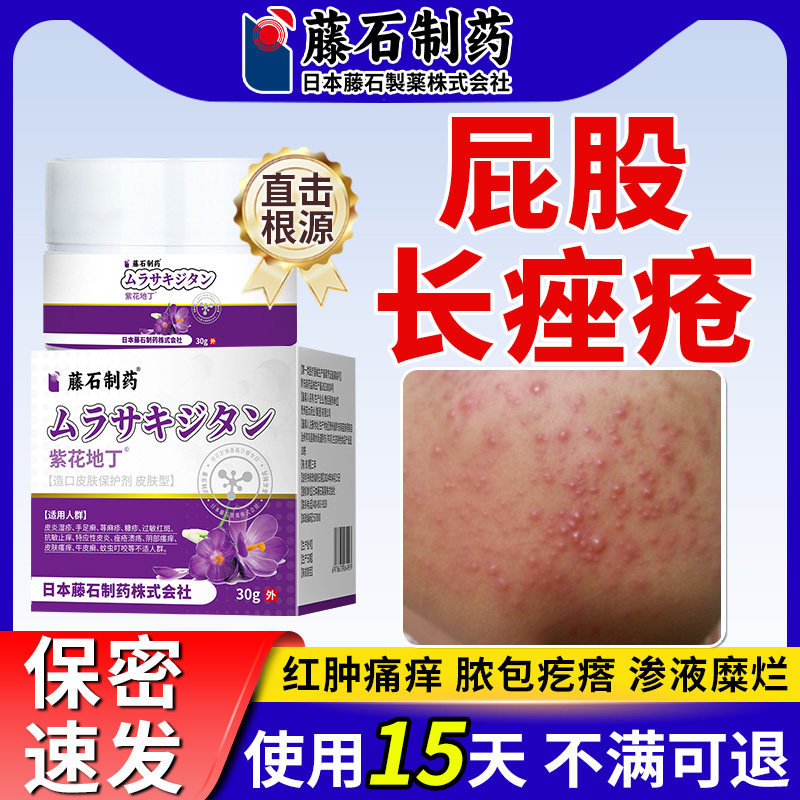 屁股上长痘痘痒起热疙瘩痤疮火疖子臀部脓包拔毒拔脓膏药贴xu
